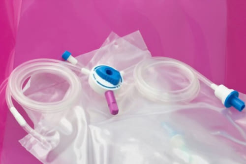 Colocación de catéter de dialisis peritoneal percutáneo.