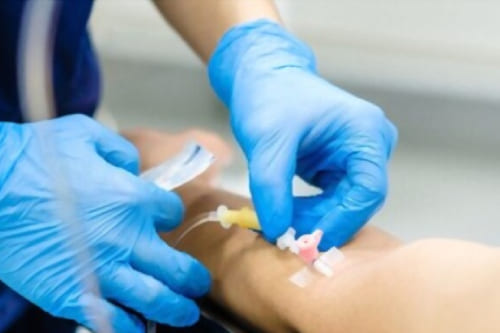 Colocación de catéter para hemodiálisis.