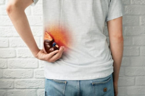 Protocolo de trasplante renal.